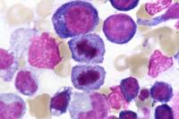 Moelle osseuse humaine cellules en mitose - télophase x4000